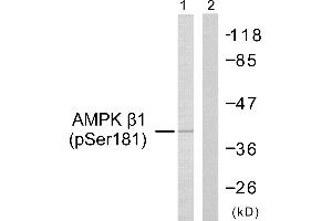 Western blot analysis of extracts from Jurkat cells, using AMPK β1 (Phospho-Ser181) Antibody (#A0410). (PRKAB1 antibody  (pSer181))