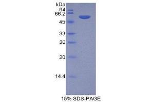 SDS-PAGE (SDS) image for Prolyl 4-Hydroxylase, beta Polypeptide (P4HB) (AA 216-465) protein (His tag,GST tag) (ABIN2123536)