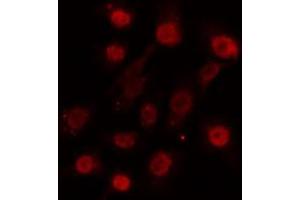 ABIN6274124 staining HuvEc cells by IF/ICC. (SUPT3H/SPT3 antibody  (Internal Region))