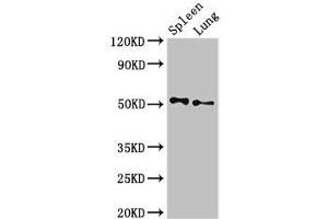 Western Blot Positive WB detected in: Rat spleen tissue, Rat lung tissue All lanes: PSEN2 antibody at 3 μg/mL Secondary Goat polyclonal to rabbit IgG at 1/50000 dilution Predicted band size: 51, 47 kDa Observed band size: 51 kDa (Presenilin 2 antibody  (AA 7-77))