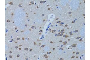 Immunohistochemistry of paraffin-embedded rat brain using PLCB1 antibody. (Phospholipase C beta 1 antibody)