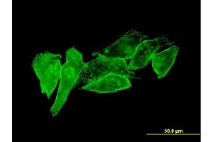 Immunofluorescence of monoclonal antibody to PSCD1 on HeLa cell. (Cytohesin 1 antibody  (AA 1-398))