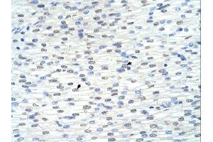 Immunohistochemistry (IHC) image for anti-Ring Finger Protein 8 (RNF8) (C-Term) antibody (ABIN2778597) (RNF8 antibody  (C-Term))
