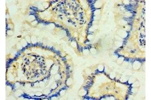 Immunohistochemistry of paraffin-embedded human small intestine tissue using ABIN7163815 at dilution of 1:100 (PKD2L1 antibody  (AA 561-805))