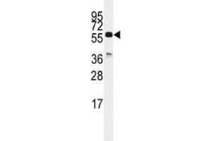 Western blot analysis of CDC25C antibody and K562 lysate. (CDC25C antibody  (AA 376-402))