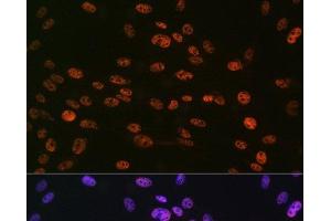 Immunofluorescence analysis of C6 cells using Phospho-Histone H3(S10) Polyclonal Antibody at dilution of 1:100 (40x lens). (Histone 3 antibody  (pSer10))
