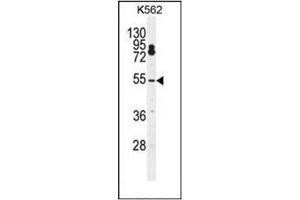 Western blot analysis of CPSF7 Antibody (C-term) Cat. (CPSF7 antibody  (C-Term))