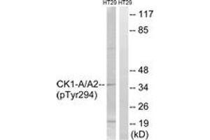 Western blot analysis of extracts from HT29 cells treated with heat shock, using CK-1 alpha (Phospho-Tyr294) Antibody. (CSNK1A1 antibody  (pTyr294))