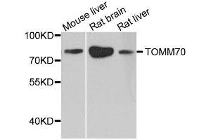 Western blot analysis of extracts of various cell lines, using TOMM70 antibody. (TOM70 antibody  (AA 60-340))