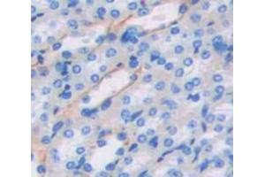 Figure. (TMEM27 antibody  (AA 15-135))