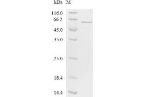 (Tris-Glycine gel) Discontinuous SDS-PAGE (reduced) with 5 % enrichment gel and 15 % separation gel.