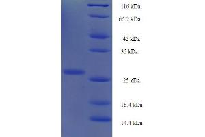 SDS-PAGE (SDS) image for Yippee-Like 1 (YPEL1) (AA 1-119), (full length) protein (His-SUMO Tag) (ABIN4974333)