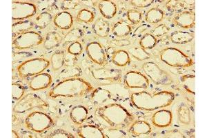 Immunohistochemistry of paraffin-embedded human kidney tissue using ABIN7172505 at dilution of 1:100 (DP2 antibody  (AA 344-386))