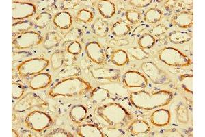 Immunohistochemistry of paraffin-embedded human kidney tissue using ABIN7172505 at dilution of 1:100 (DP2 antibody  (AA 344-386))