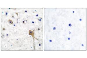 Immunohistochemical analysis of paraffin-embedded human brain tissue using SH-PTP2 antibody (ABIN5976504). (PTPN11 antibody  (Internal Region))