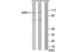 Western blot analysis of extracts from HuvEc/HeLa cells, using MKL1 Antibody. (MKL1 antibody  (AA 10-59))