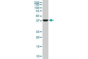 COPS3 monoclonal antibody (M02A), clone 2D10. (COPS3 antibody  (AA 324-422))
