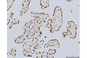 IHC analysis of LSM8 using anti-LSM8 antibody (ABIN7599578).