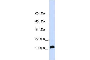 WB Suggested Anti-NHLH1 Antibody Titration: 0.