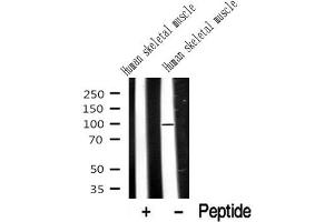 Western blot analysis of extracts of Human skeletal muscle? (Dystroglycan antibody  (C-Term))