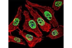 Fluorescent confocal image of A549 cell stained with FOXA2 antibody at 1:25. (FOXA2 antibody  (AA 128-157))
