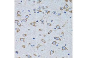 Immunohistochemistry of paraffin-embedded rat brain using RARS antibody (ABIN5973728) at dilution of 1/100 (40x lens). (RARS antibody)