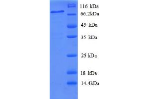 SDS-PAGE (SDS) image for Phospholipid Transfer Protein (PLTP) (AA 18-493) protein (GST tag) (ABIN4975930)