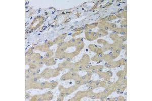 Immunohistochemistry of paraffin-embedded human liver injury using ATAD3B antibody (ABIN5974542) at dilution of 1/100 (40x lens).
