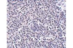 Immunohistochemistry (IHC) image for anti-ADP-Ribosylation Factor-Like 15 (ARL15) (Middle Region) antibody (ABIN1030866) (ARL15 antibody  (Middle Region))