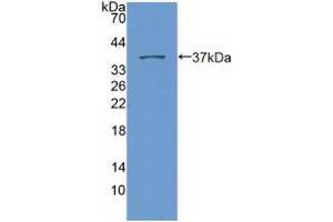 Detection of Recombinant Nesp2, Human using Polyclonal Antibody to Nesprin 2 (Nesp2) (SYNE2 antibody  (AA 6-296))