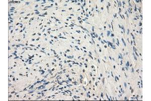 Immunohistochemical staining of paraffin-embedded endometrium tissue using anti-MAP2K1 mouse monoclonal antibody. (MEK1 antibody)