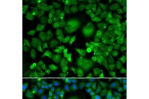 Immunofluorescence analysis of A549 cells using UBE2H Polyclonal Antibody (UBE2H antibody)