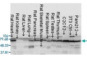 Western blot analysis from rat tissu and cell lysates with AKT2 polyclonal antibody . (AKT2 antibody)
