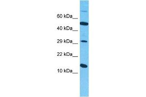 Host:  Rabbit  Target Name:  SYUB  Sample Type:  786-0 Whole Cell lysates  Antibody Dilution:  1ug/ml (beta Synuclein antibody  (C-Term))