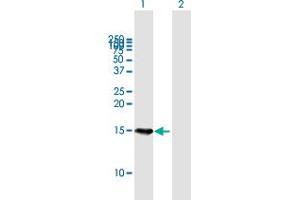 Western Blot analysis of B9D1 expression in transfected 293T cell line by B9D1 MaxPab polyclonal antibody. (B9D1 antibody  (AA 1-153))