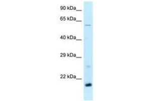 Image no. 1 for anti-TATA-Binding Protein-Associated Phosphoprotein (DR1) (AA 63-112) antibody (ABIN6747863) (DR1 antibody  (AA 63-112))