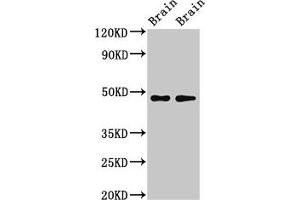 Western Blot Positive WB detected in: Rat brain tissue, Mouse brain tissue All lanes: CRHR2 antibody at 3 μg/mL Secondary Goat polyclonal to rabbit IgG at 1/50000 dilution Predicted band size: 48, 51, 47, 45, 43 kDa Observed band size: 34 kDa (CRHR2 antibody  (AA 20-108))
