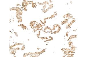 Immunocytochemistry (ICC) image for anti-Nuclear Factor-kB p65 (NFkBP65) (C-Term) antibody (ABIN7795799) (Recombinant NF-kB p65 antibody  (C-Term))