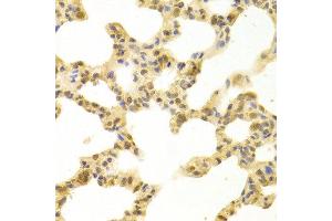 Immunohistochemistry of paraffin-embedded rat lung using POLB antibody at dilution of 1:100 (x400 lens). (POLB antibody)