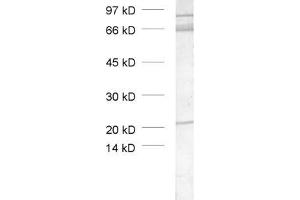 dilution: 1 : 1000, sample: crude synaptic vesicle fraction of rat brain (LP2) (TRIM9 antibody  (AA 1-250))