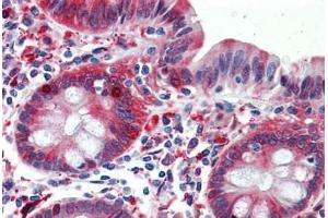 Human Colon: Formalin-Fixed, Paraffin-Embedded (FFPE)