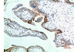 Immunohistochemical analysis of paraffin-embedded human-placenta, antibody was diluted at 1:200