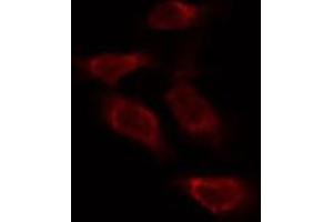 ABIN6273994 staining Hela by IF/ICC. (TUBB1 antibody)