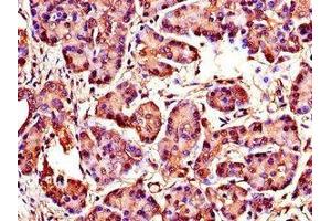 Immunohistochemistry of paraffin-embedded human pancreatic tissue using ABIN7175846 at dilution of 1:100 (WISP1 antibody  (AA 130-251))