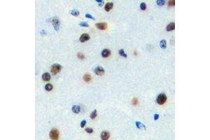 Immunohistochemical analysis of ZNF785 staining in human brain formalin fixed paraffin embedded tissue section. (ZNF785 antibody)