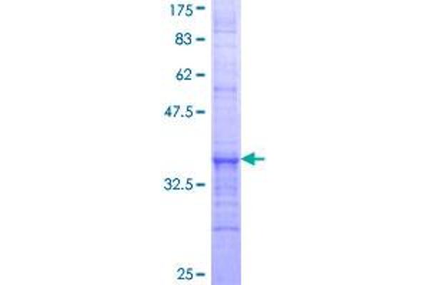 ACOX3 Protein (AA 632-700) (GST tag)