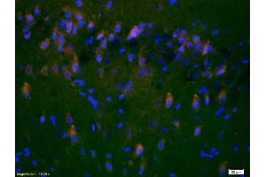 Formalin-fixed and paraffin-embedded rat brain labeled with Anti-NR2A/NMDAR2A Polyclonal Antibody, Unconjugated (ABIN747353) 1:200, overnight at 4°C, The secondary antibody was Goat Anti-Rabbit IgG, Cy3 conjugated used at 1:200 dilution for 40 minutes at 37°C.
