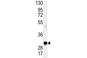 Western Blotting (WB) image for anti-Cyclin D1 (CCND1) (AA 68-97) antibody (ABIN3030588)