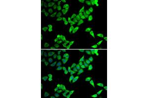 Immunofluorescence analysis of U2OS cells using TRIP10 antibody (ABIN5974234). (TRIP10 antibody)