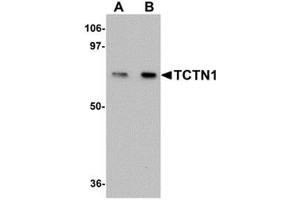 Western blot analysis of TCTN1 in mouse kidney tissue lysate with TCTN1 antibody at (A) 1 and (B) 2 μg/ml. (TCTN1 antibody  (N-Term))